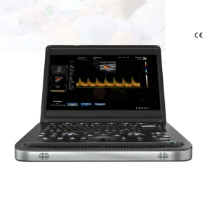 15.6 Inch Color Doppler 3D Ultrasound Machine Echograph System SUN-902B Electric High Resolution Medical Display Built-in