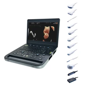 3D 4D Imaging Color Doppler Ultrasound Diagnostic System Laptop Color Ultrasound Machine with PW CW Function