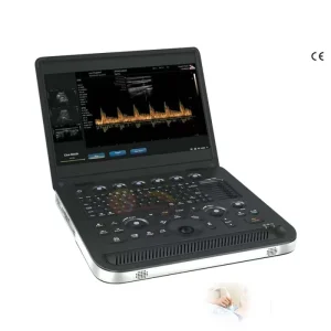 CE Approved Portable Digital B Ultrasound Convex Rechargeable Battery 3D Imaging 15.6″ Display Image Print Function for Clinic
