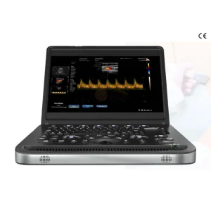 Hospital Use Portable Electricity Laptop Color Doppler Ultrasound Machine Dual Probe Interface 3D Imaging 15.6inch