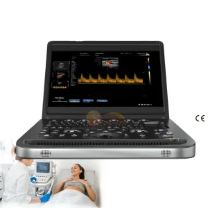 Portable SUN 902B Human Use Laptop Color Doppler Ultrasound Machine 2D 3D Echo Full Digital Ultrasound Scanner