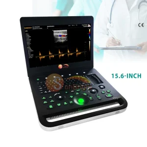 SUN-902B 15.6-Inch LED Screen Electricity Powered Portable Diagnostic System 3D Notebook Laptop Color Doppler Machine